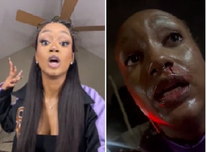 American influencer vacationing in Ghana alleges bloody assault by bouncer