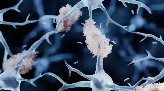 A 19-year-old suffers from Alzheimer’s – Reports