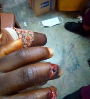 Nursing mother accused of mutilating 5-year-old boy for allegedly stealing fish