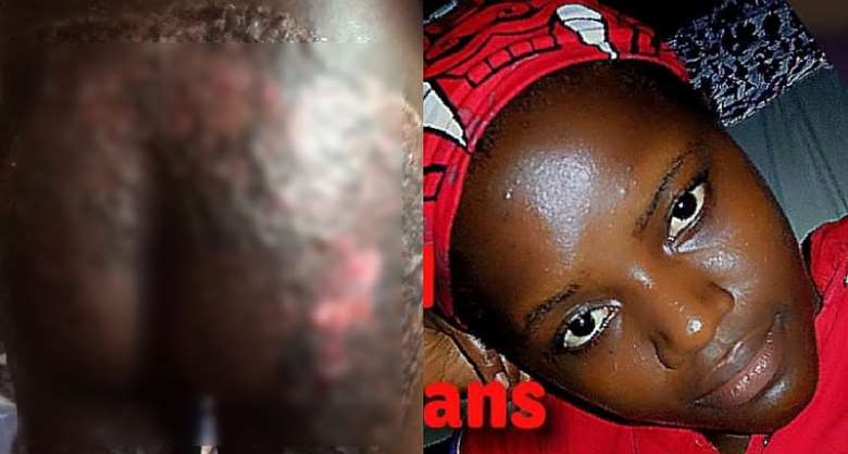 Stepmother ‘cooks’ 8-year-old stepson’s buttocks with hot water