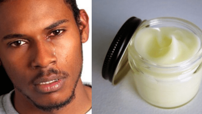 Man uses an online-purchased enlargement cream, which results in bleached manhood
