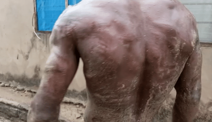 We were further beaten at Burma Camp – Victim of Ashaiman military brutality