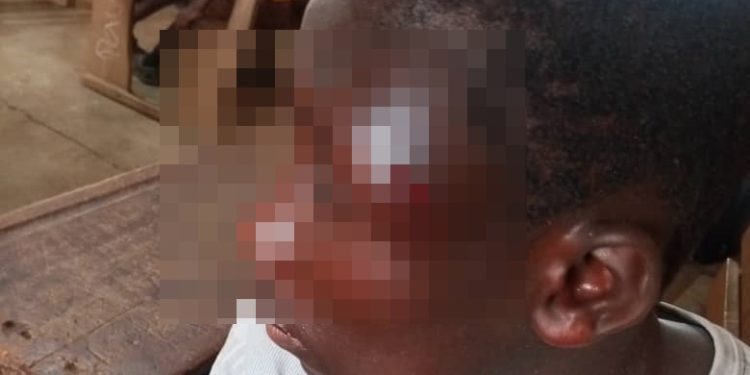 Guardians beat JHS student with iron rod for alleged GHS50 theft