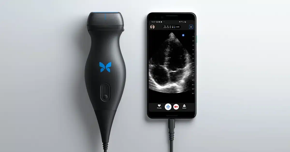 Butterfly IQ, the new stethoscope?