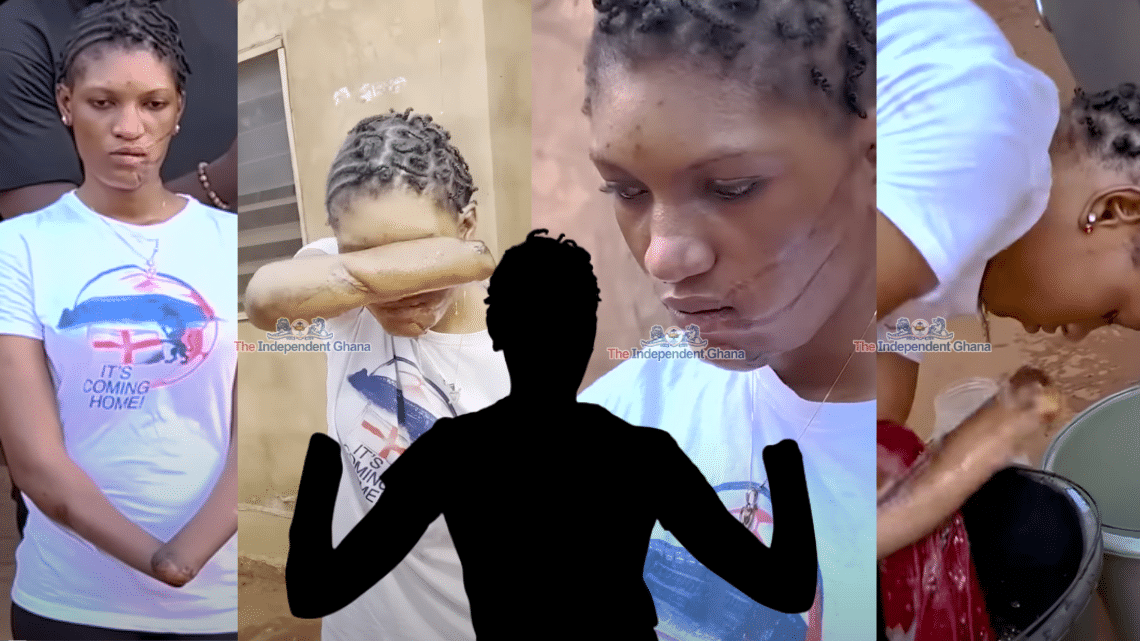 My own mother cut off my hands and ruined my life: A shocking tale of tragedy!