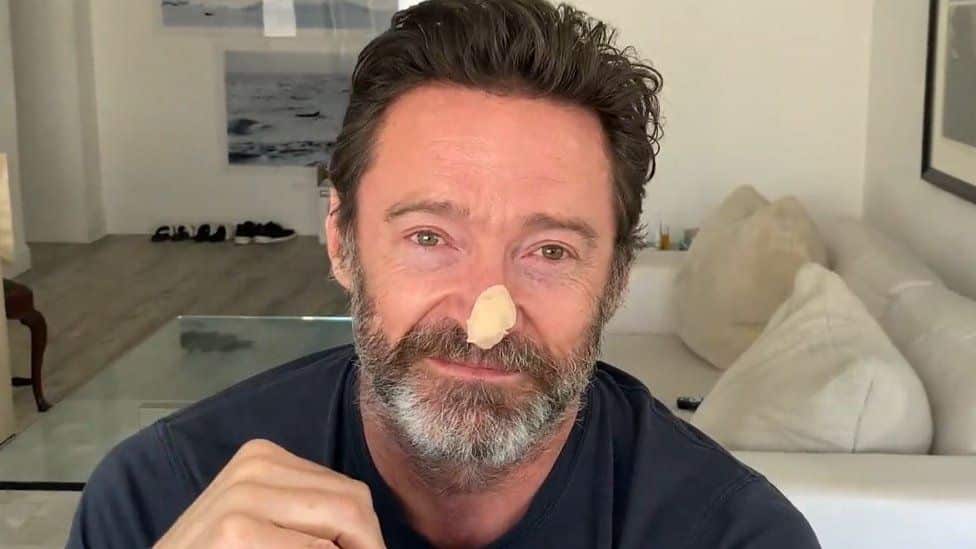 Hugh Jackman warns followers to use sunscreen after learning of a new skin cancer scare