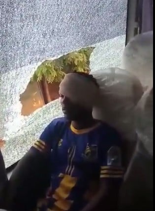 Tamale City player injured in the eye  after attack by Aduana FC supporters