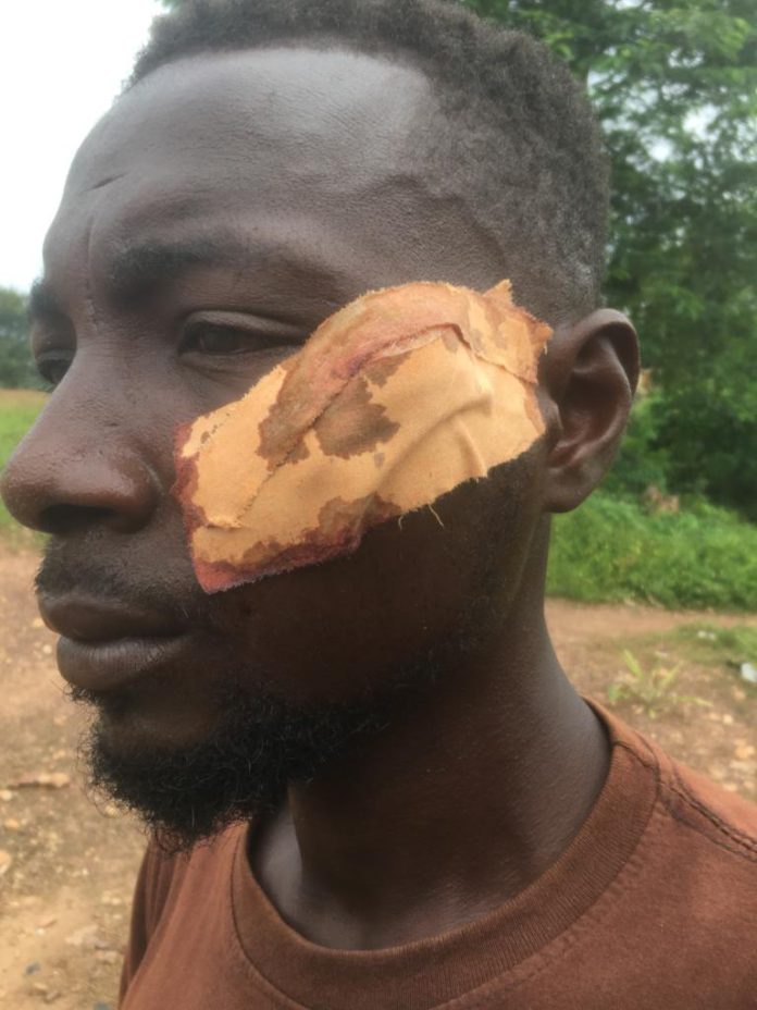 Seven people suffer severe wounds during a ‘fight over woman’ at a wake