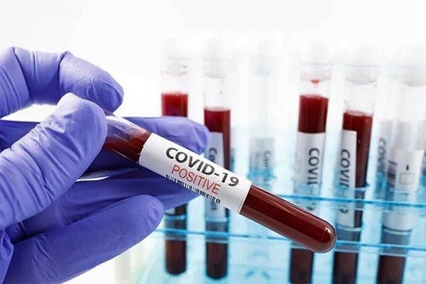  31 new cases of COVID-19 recorded by Ghana Health Service
