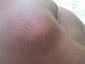 Party thugs assault Nasara Coordinator in Atebubu