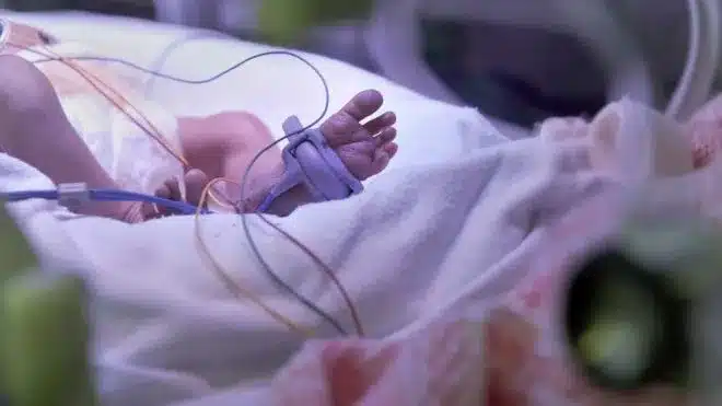 Tanzanian nurses to face charges for harvesting organs of baby twins