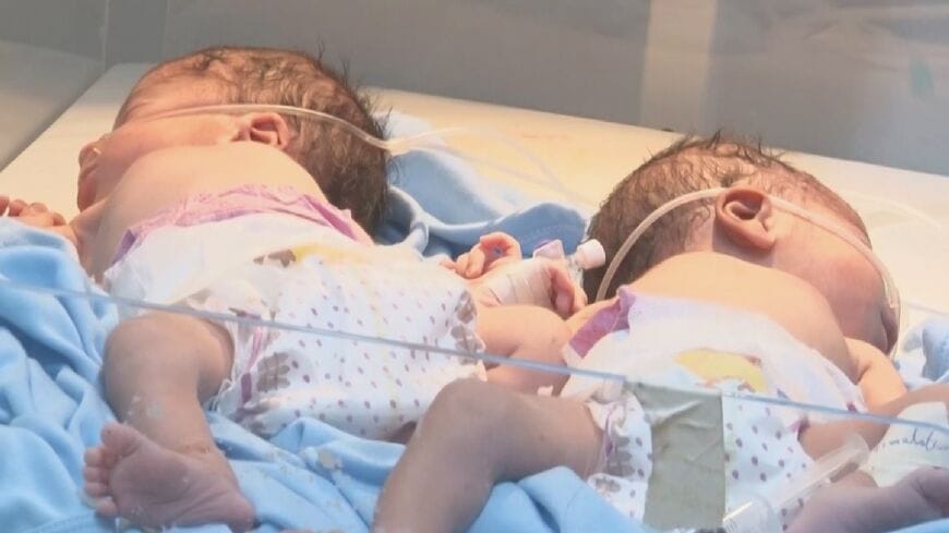 Maternity facility in Sudan struggles to preserve lives