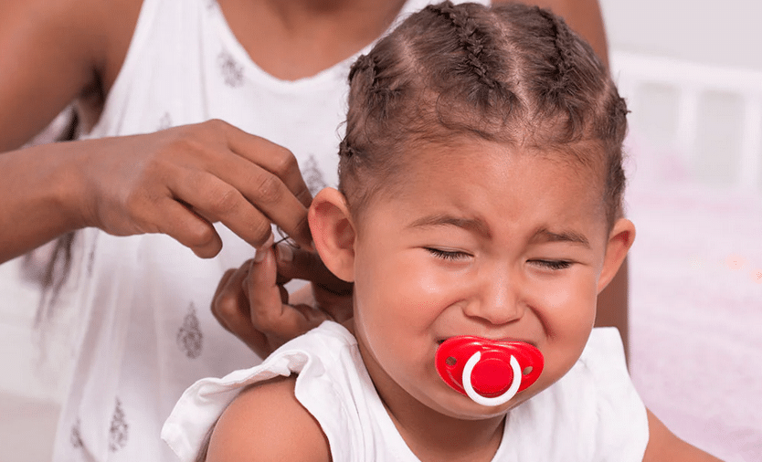 Tight braids for infants has an effect on the scalp – Pediatrician