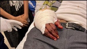 UG Lecturer in critical state after robbery attack