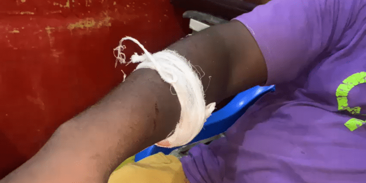 Clash between alleged land guards, wood sellers in Ashanti Region leaves 2 injured