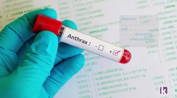 First Anthrax case officially confirmed in Nigeria