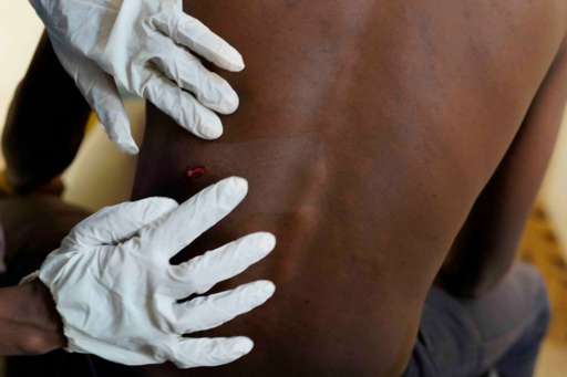 MSF in Khartoum at risk after the targeting of one of their convoys