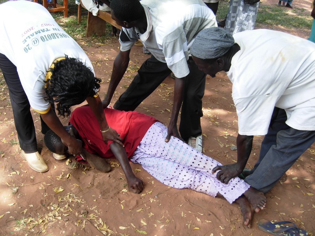 Epilepsy cases on the rise at Kadjebi – MHA