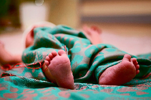 Mother abandons deformed baby at Korle-Bu Teaching Hospital