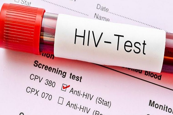 50 Ghanaians contract HIV daily – AIDS Commission