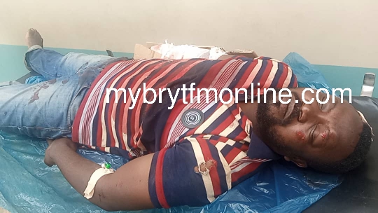 Media General, Multimedia journalists en route to cover Bibiani-Anhweaso road accident suffer same fate