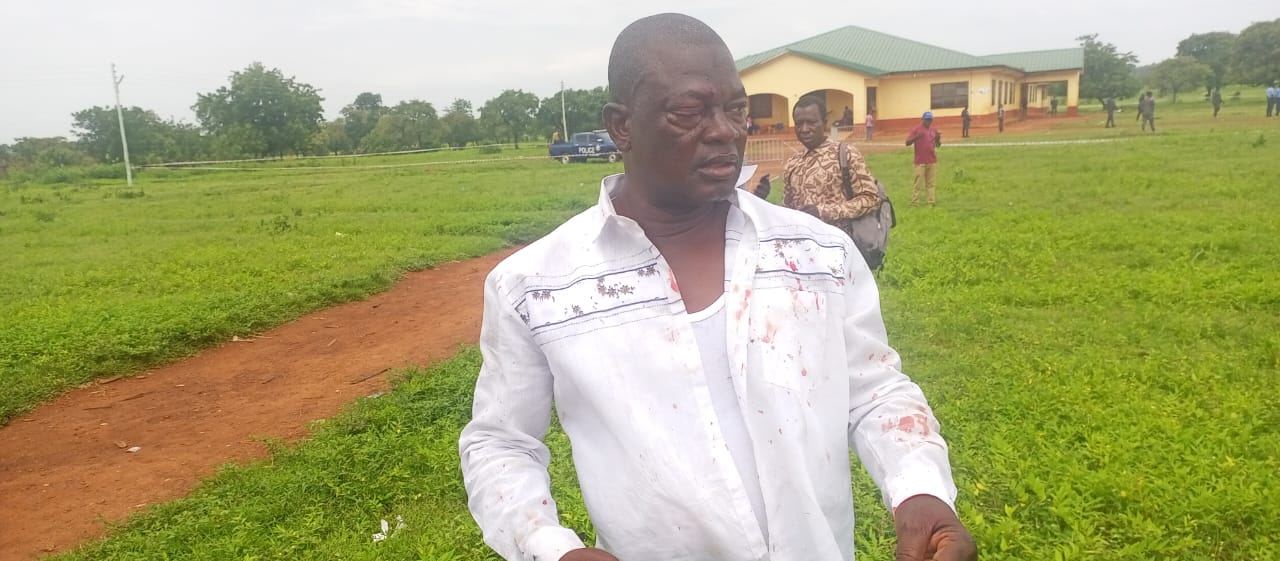 Alan’s campaign coordinator for N/E region allegedly  beaten to a pulp by voters 