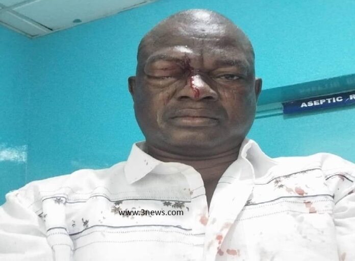 Alan’s agent tried to snatch a ballot paper from a voter – North East NPP respond to alleged assault