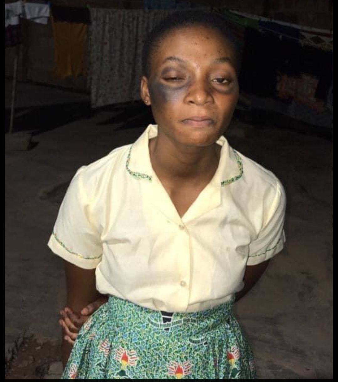 Victim of assault at Nkwatia Presby SHS receiving medical care – GES