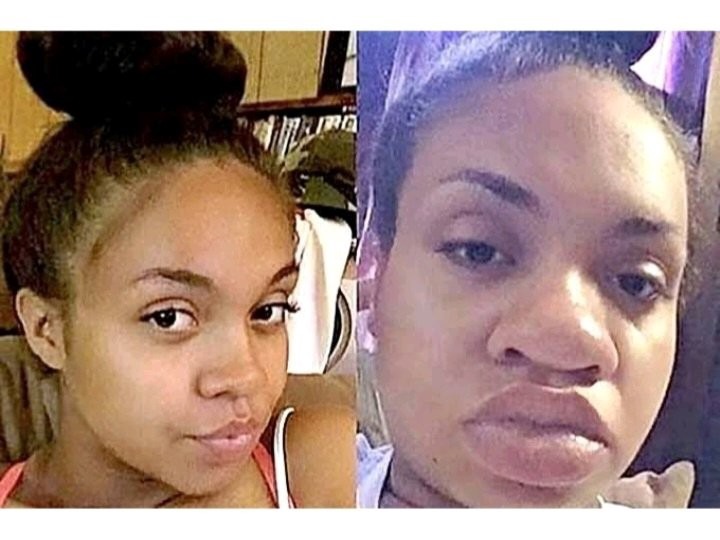 Reasons women’s nose grows bigger during pregnancy