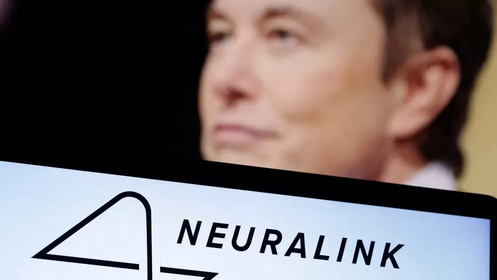 People needed for brain-implant experiment by Musk startup