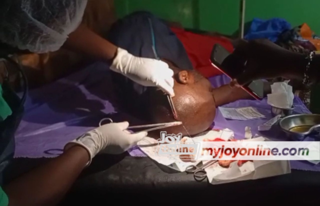 Limited voters’ registration at Agona West turns bloody