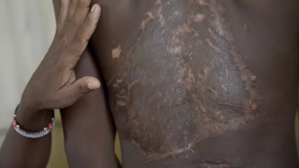 Kenyan student beaten into coma for taking extra food at school – Father