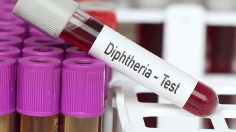 600 people in Nigeria die from diphtheria outbreak