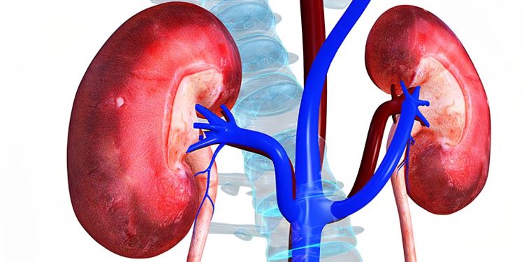 Embrace healthy living to save your kidney – Ghana Kidney Association to Ghanaians