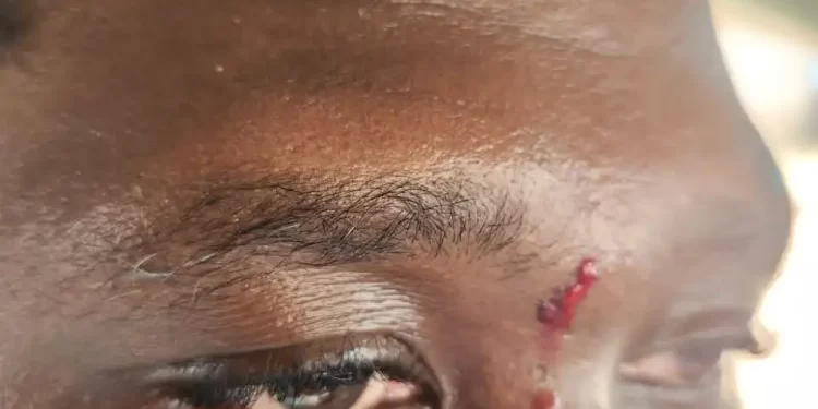 Chief Imam’s security guard allegedly assaults GHOne TV presenter