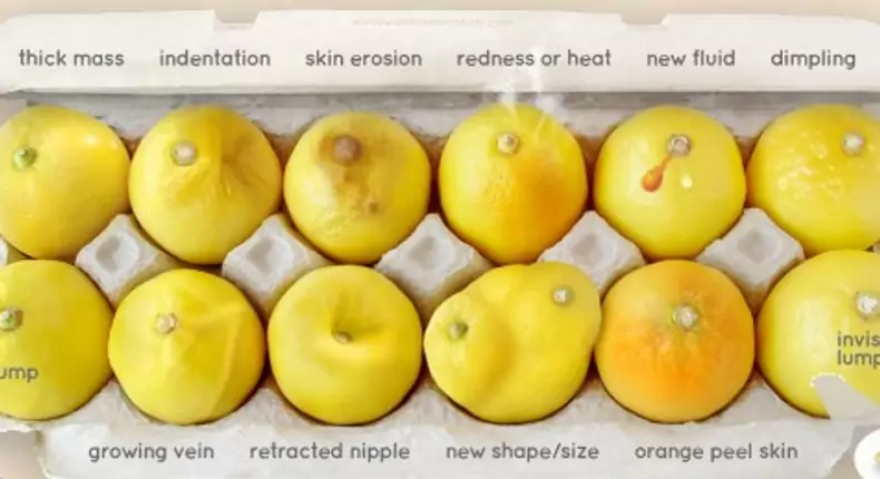 Pay attention to these signs in your breast and seek medical attention