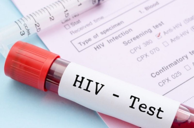 FDA warns of fake HIV test kits, cites wrong manufacturers, expiry dates