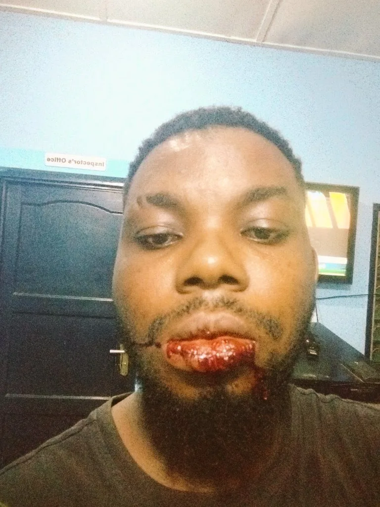 Ladies reportedly ‘assault’ Bolt driver for refusing to give them an offline ride
