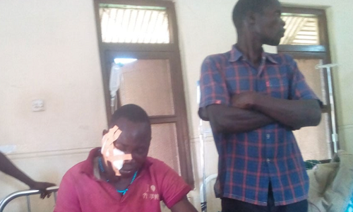 Man fails to protect his genitals in fight over a woman