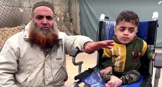 Israeli-Hamas war: Little boy with brittle bones living in tent