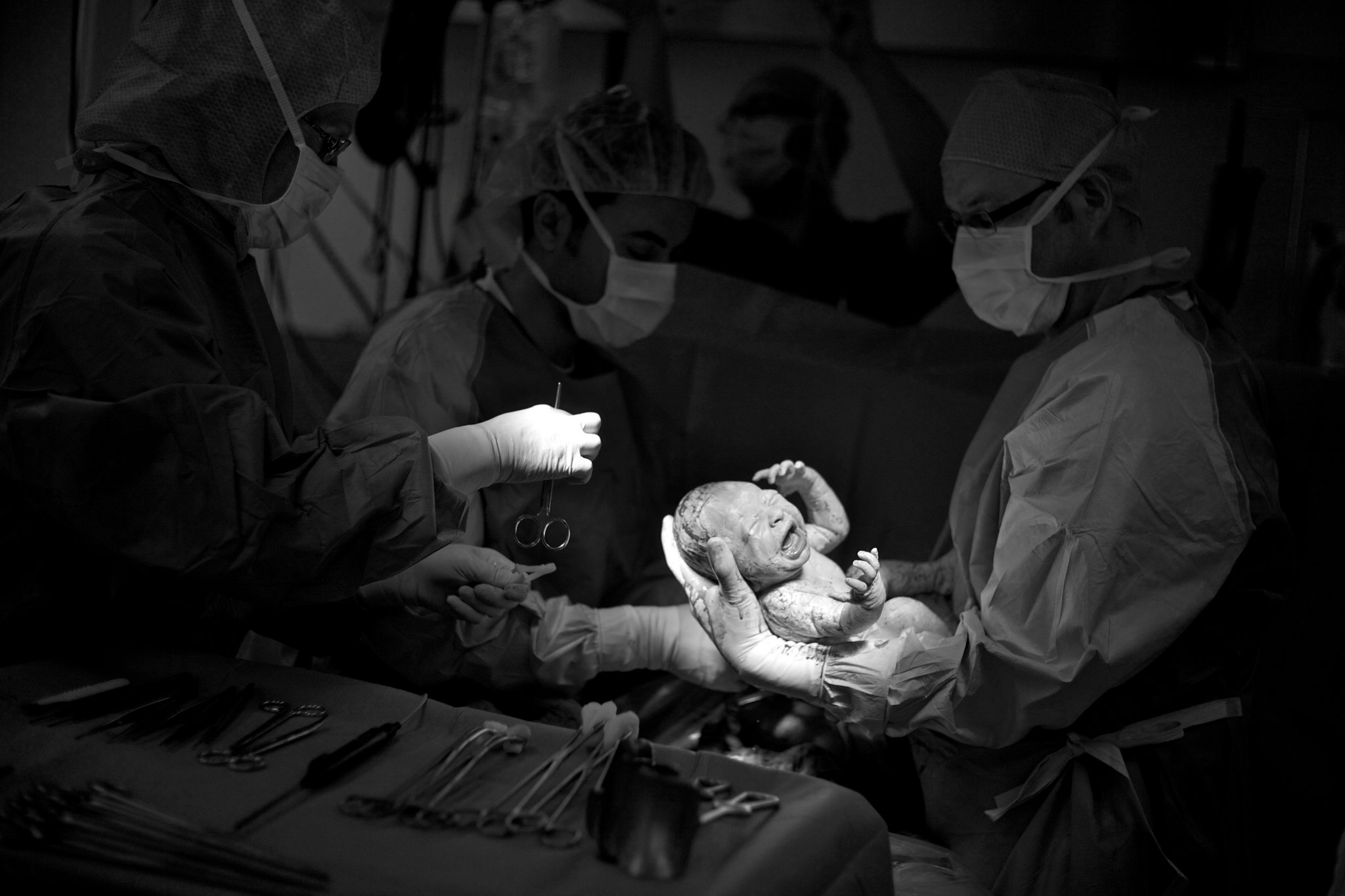 Prevalence of C-section during childbirth on the rise – GHS
