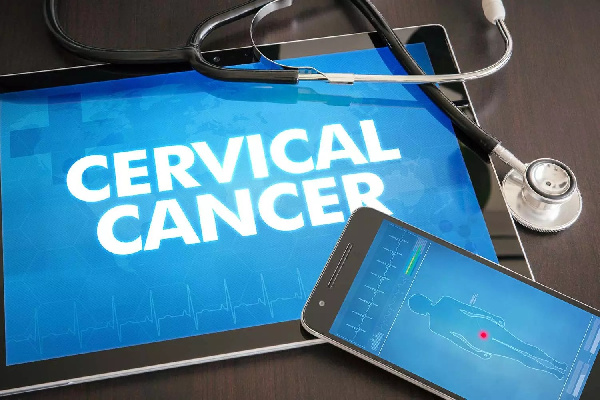 Alarming rate of cervical cancer claiming lives of to many young women in Ghana – Gynaecologists 