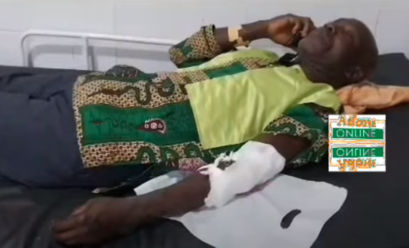 Robbers steal ambulance during operation on Accra-Yeji road, injure 7