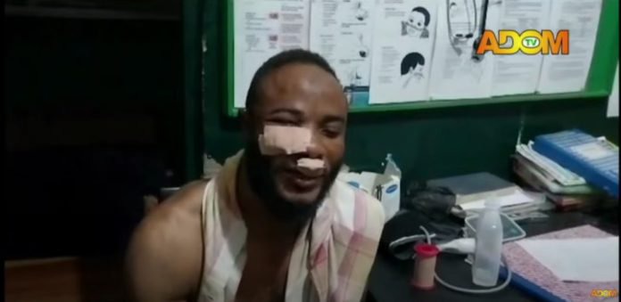 NPP Primaries: Party Executive assaulted