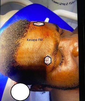 Altercation erupts at NPP Parliamentary Primaries voting center over alleged spiritual incantation