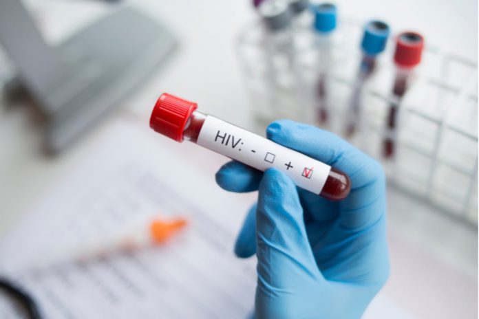 More Ghanaians contracting HIV; new cases surge by 7%