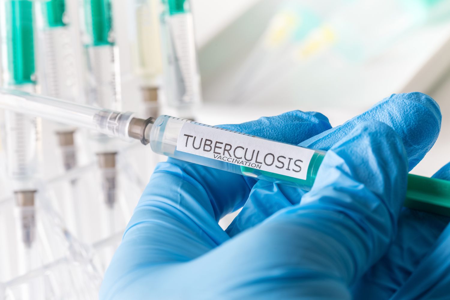 Tuberculosis cases soar in Ghana: Health experts call for urgent action