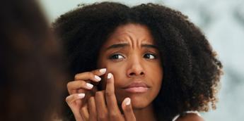 Milk magic: A natural solution for fading scars