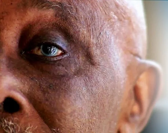 Glaucoma Patients call for 50% tax cuts on medications