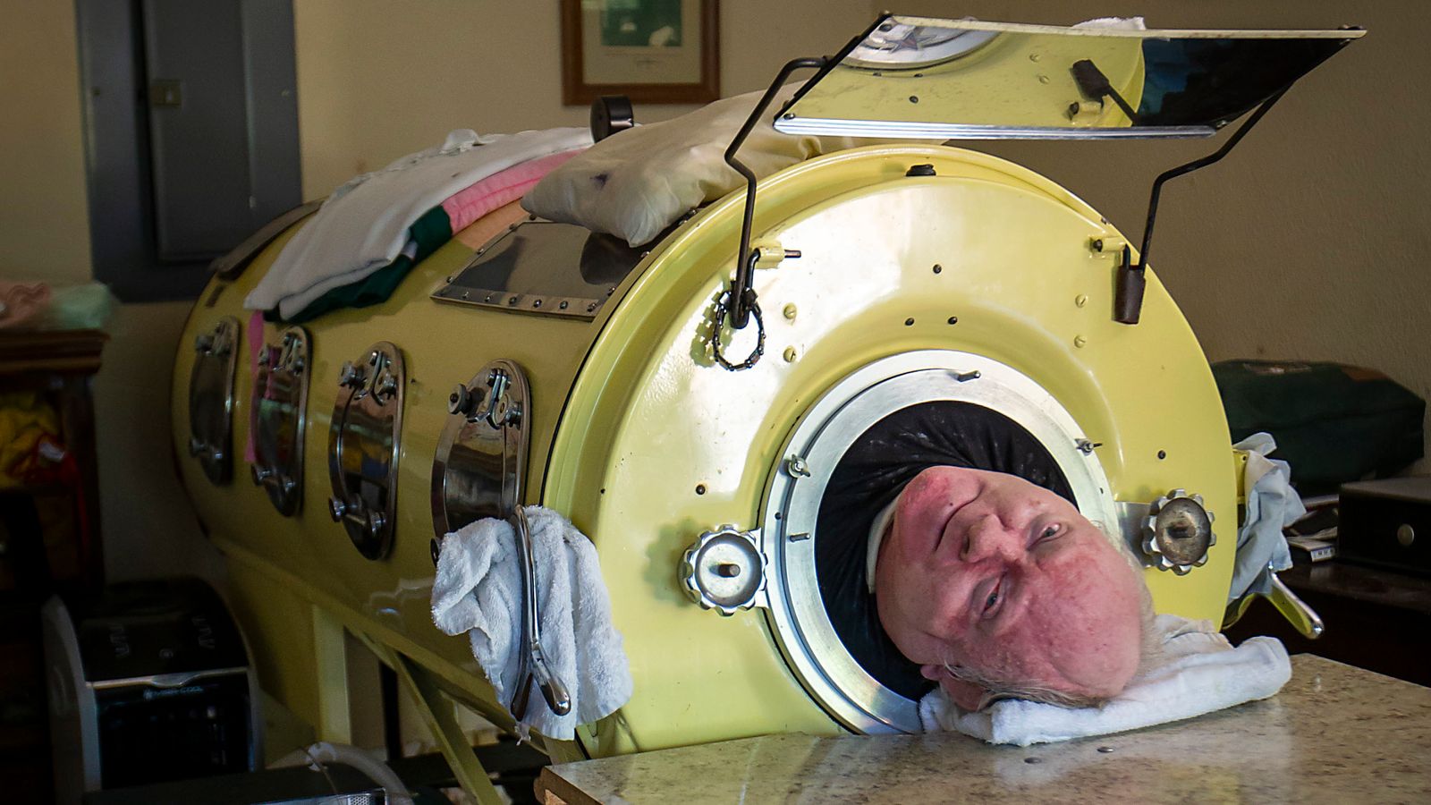 Paul Alexander passes away after 70 years in tank